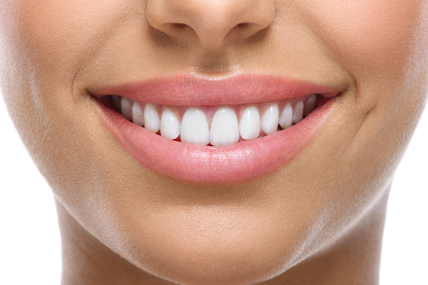 Smile Correction