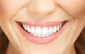 Full mouth rehabilitation
