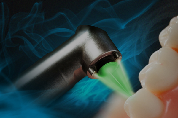 laser-dentistry