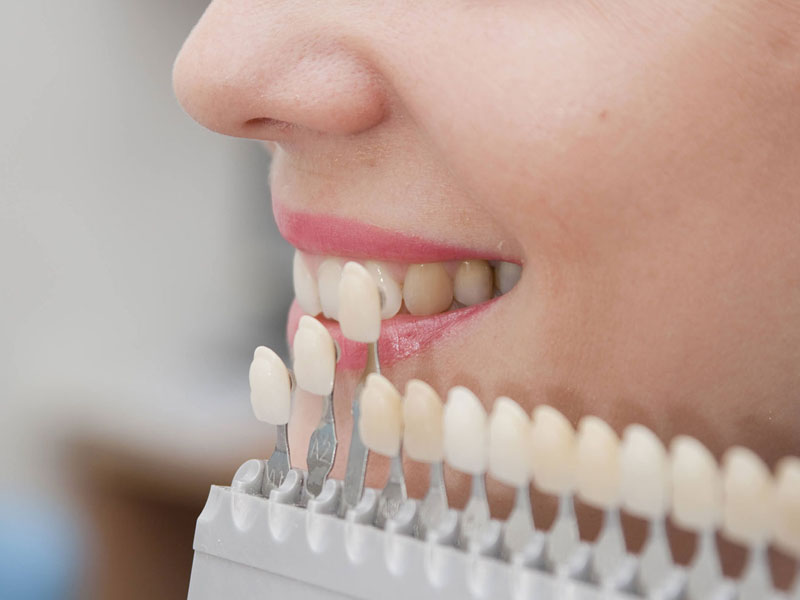 restorative dentistry